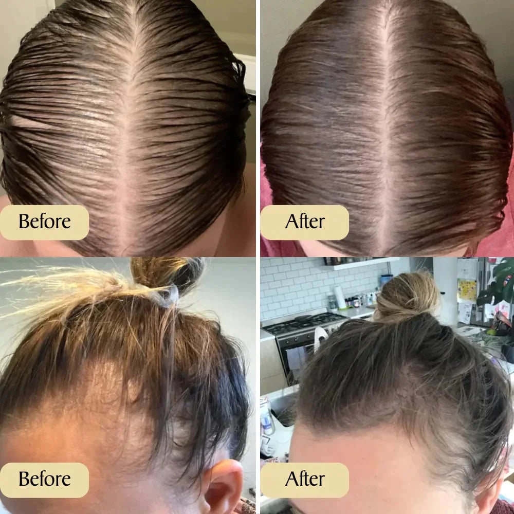 Vegan Hair Growth Oil®