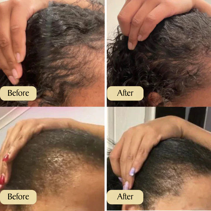 Vegan Hair Growth Oil®